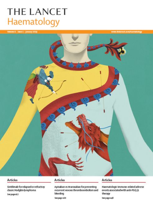 信迪利单抗诞生记!唯一进入中国医保的PD-1产品