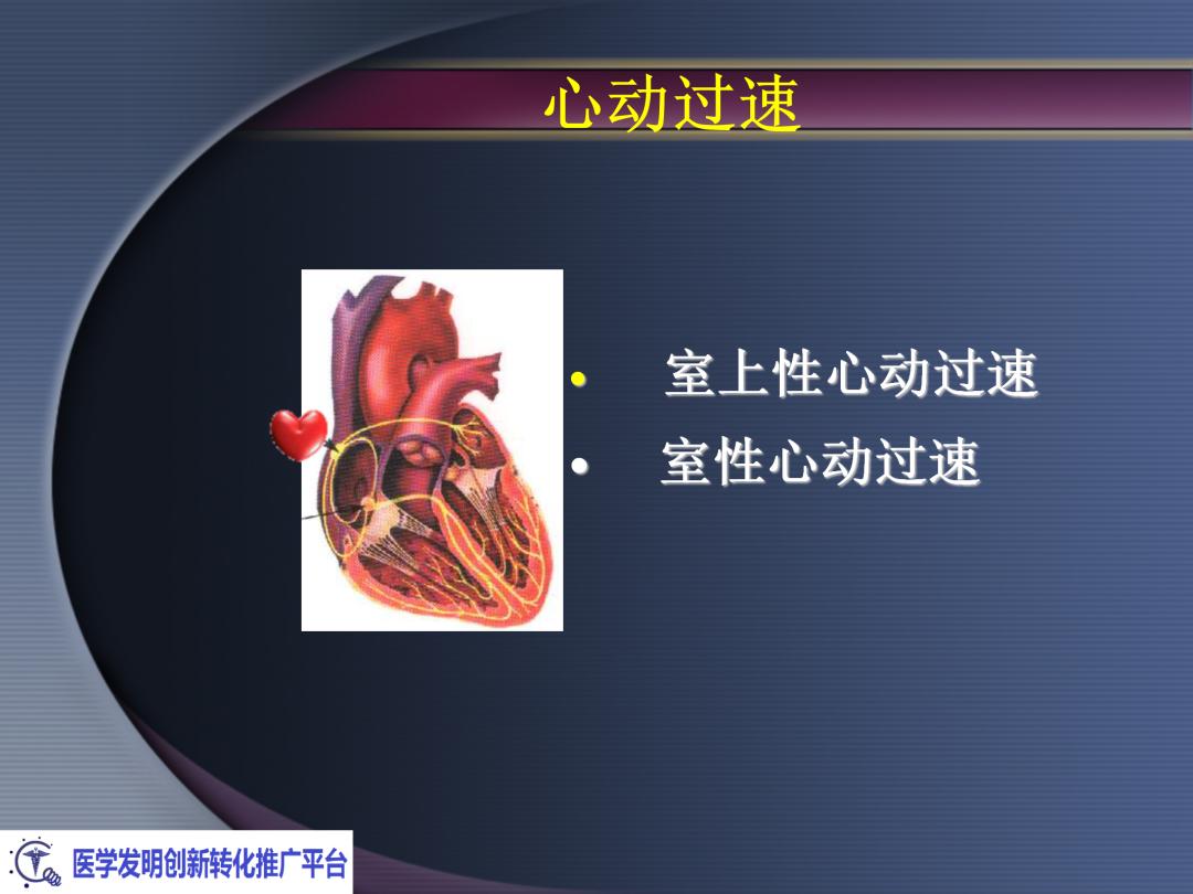 麻醉手术常见心律失常处理,麻醉引起心脏骤停原因