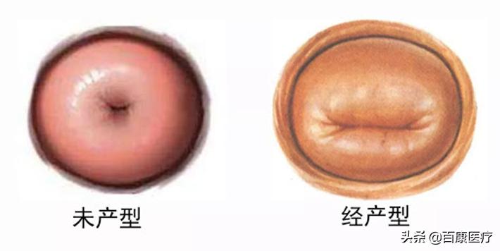 婚前做过人流瞒着老公想摊牌,婚前做人流对以后怀孕有影响吗