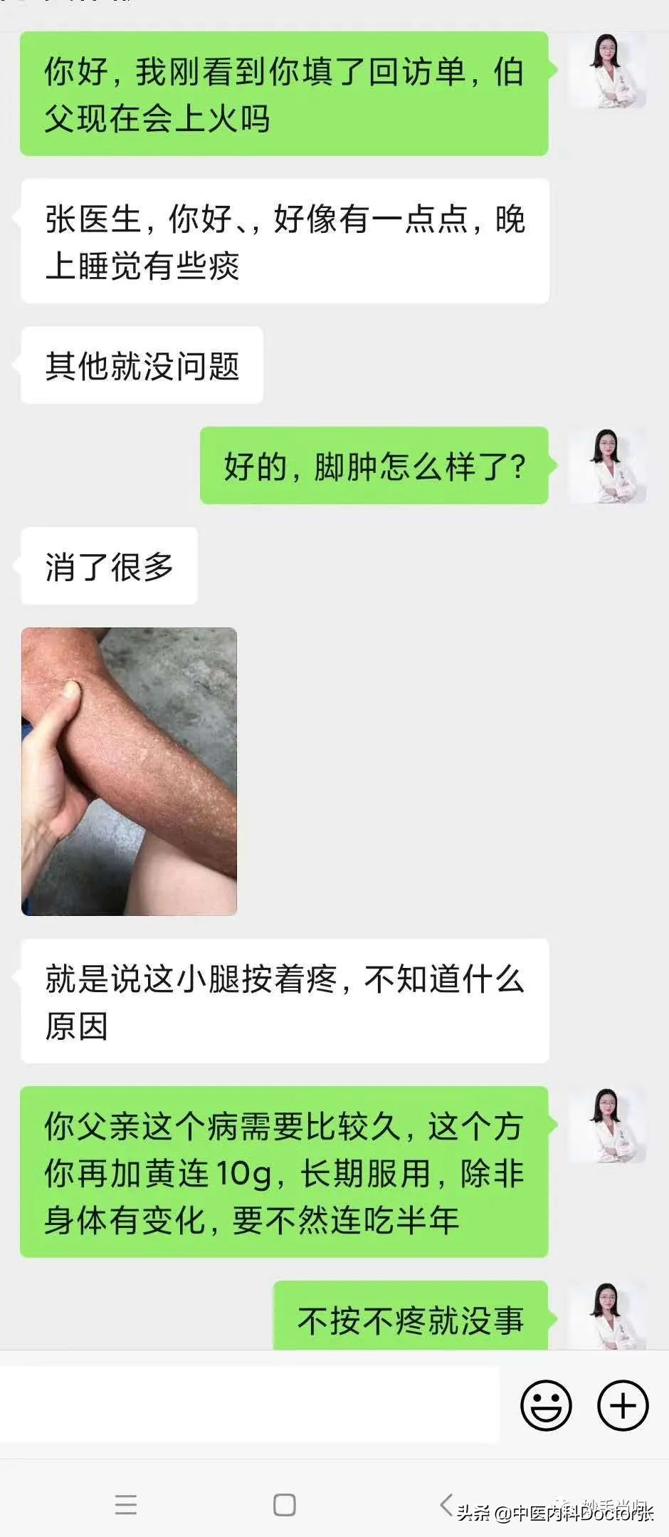 老人脚水肿按压塌陷治疗方法,老人脚水肿一按一个洞