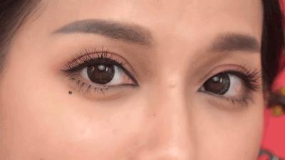 祛除眼袋的小妙招红霉素软膏,用什么可以祛除黑眼圈和眼袋