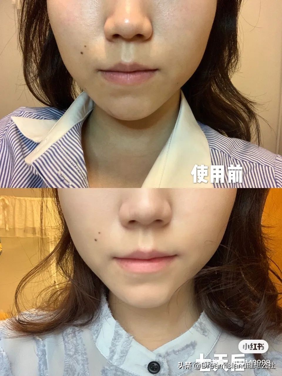 皮肤太白会不会有问题,皮肤太白涂什么好