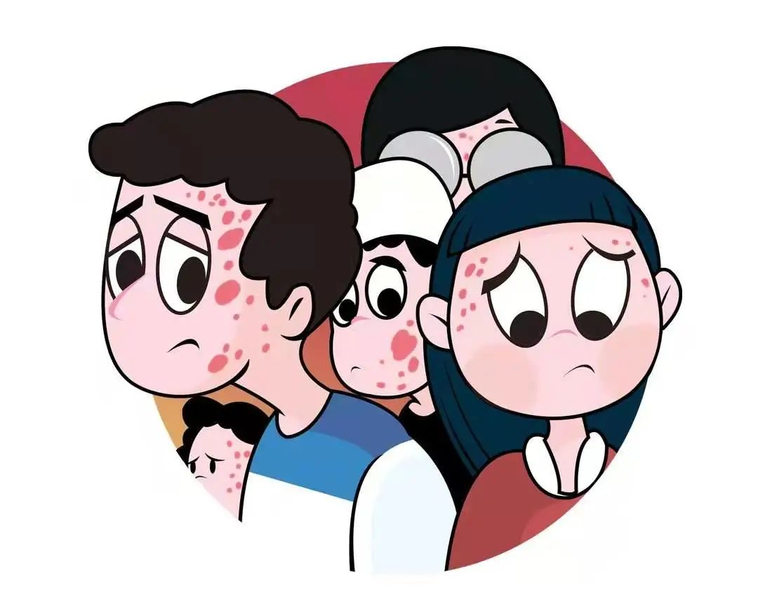 中药治疗银屑病外洗的方子,治疗银屑病的中药外用药膏