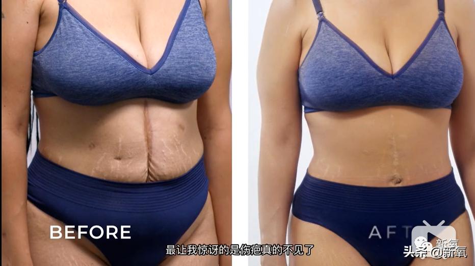 刘诗诗最近生图,刘诗诗旧照脸又胖又大