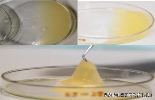 长治二院胬肉手术,长治二院拇外翻手术