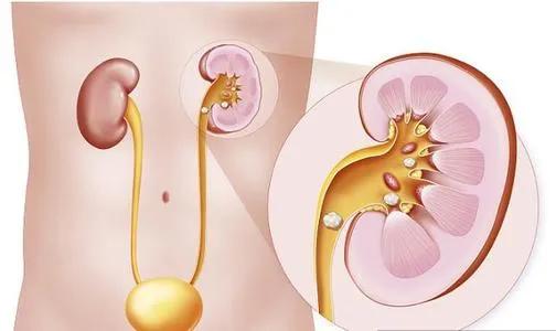 男子因腹痛被紧急送医丧命,男子腹痛难忍送医后猝死
