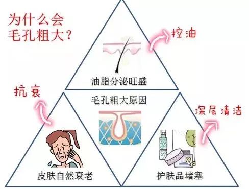 男生面部皮肤粗糙出油毛孔大,皮肤出油多毛孔大怎样改善