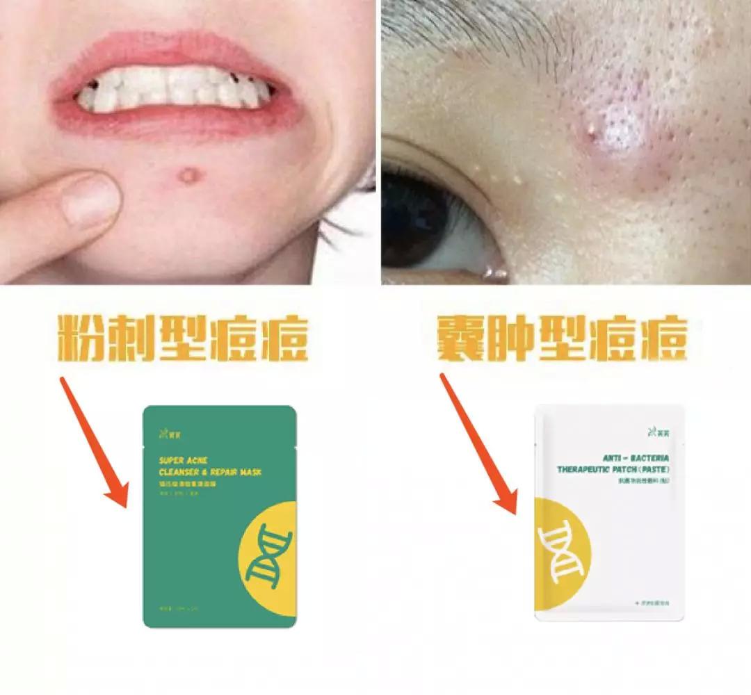 平价好用的医美面膜,最好用的平价美白面膜排行榜