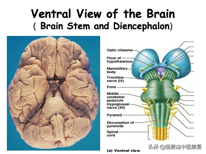 中枢神经系统断层解剖讲解,中枢神经3d解剖动画