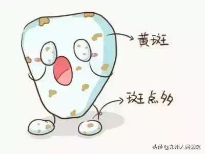 一岁孩子全是坏牙,一岁半宝宝牙齿有色素