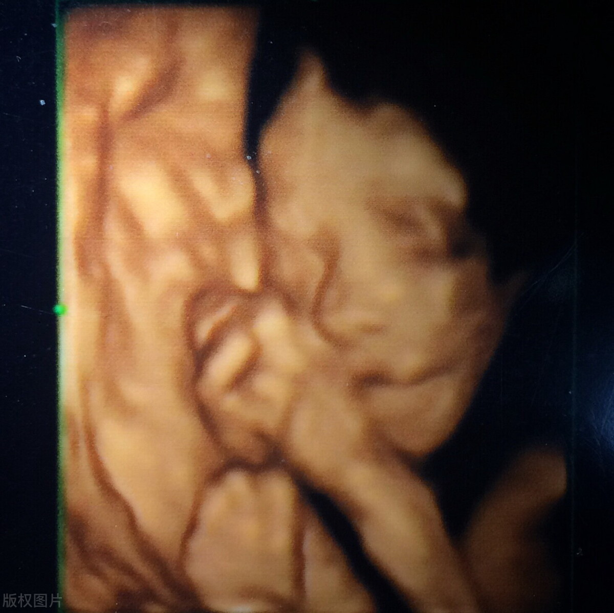 怀孕产检可以不查骨密度吗,怀孕产检可以不建档吗