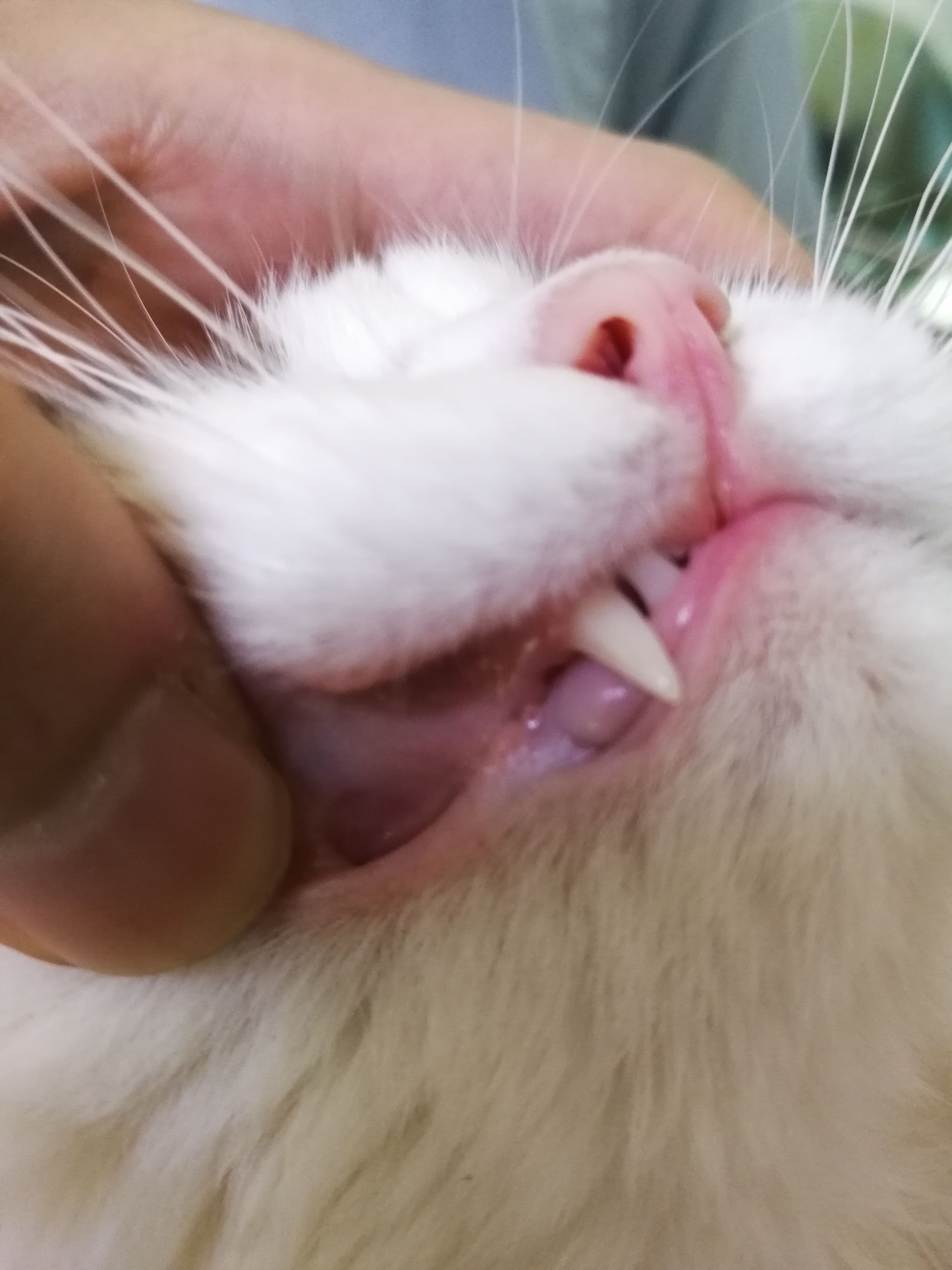 一招逆转脂肪肝,健康脂肪肝一个方子就解决