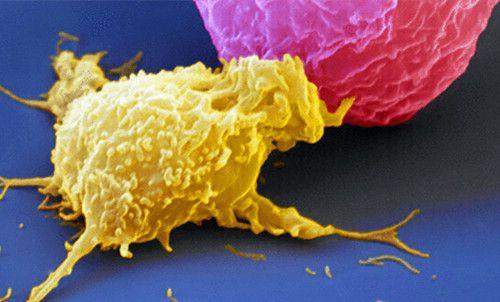 治疗癌症的免疫治疗是什么意思,15种癌症免疫治疗方案