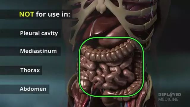 突破传统止血局限：美军战场止血利器X-stat