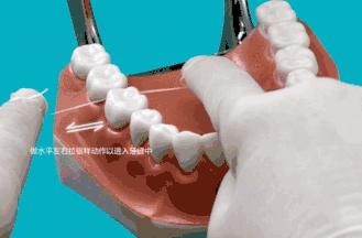 Helen齿科中心——如何使用牙线