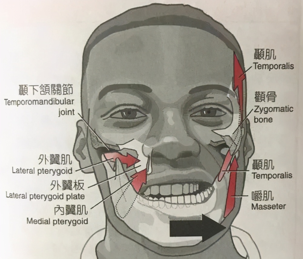 颧骨凸起怎么矫正图解,高颧骨脸型如何矫正