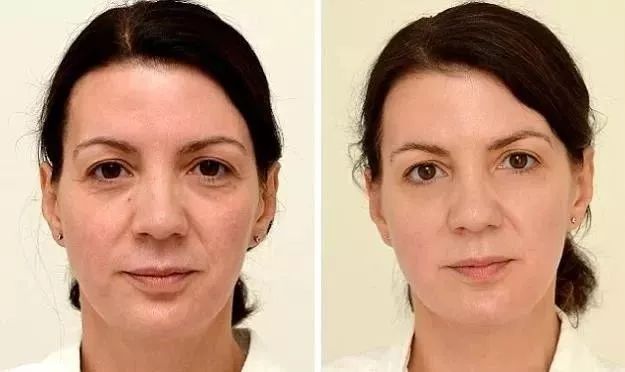 赵露思推荐补水保湿,赵露思推荐水感保湿焕颜面霜