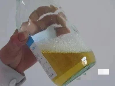 尿蛋白弱阳性对胎儿有影响吗,尿蛋白弱阳性是肾炎的初期吗