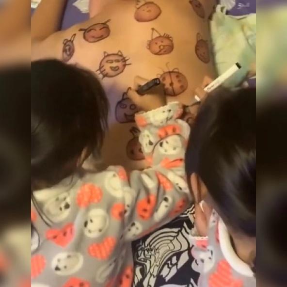 爸爸拔罐留下的印子,爸爸拔火罐后续