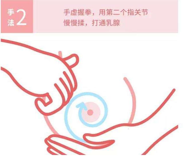 产后涨奶土豆怎么敷,产后3天奶涨怎么办