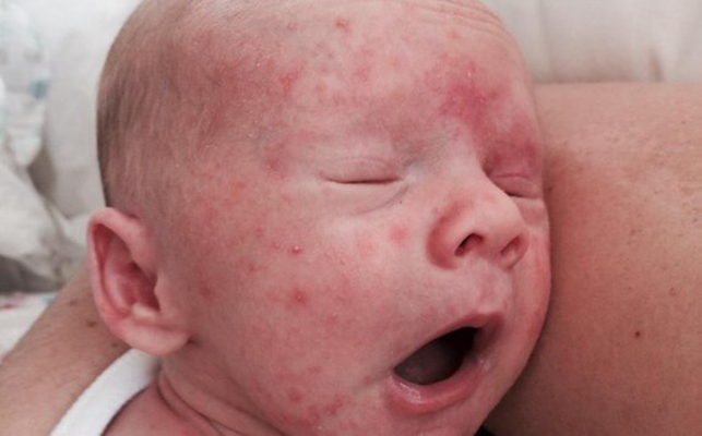 宝宝体重太轻怎么办,宝宝体重减轻不长肉