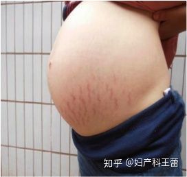 女性在怀孕后身体会发生什么变化,女性受孕后身体会发生哪些变化