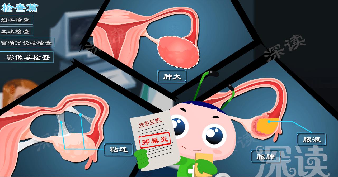 腹痛白带异常,腹部疼痛白带多的原因慢性盆腔炎