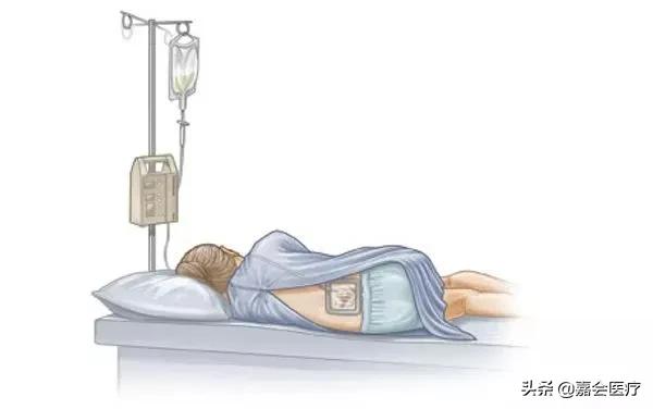 生娃痛到底是哪里痛,疼痛难忍痛不欲生的治疗现场