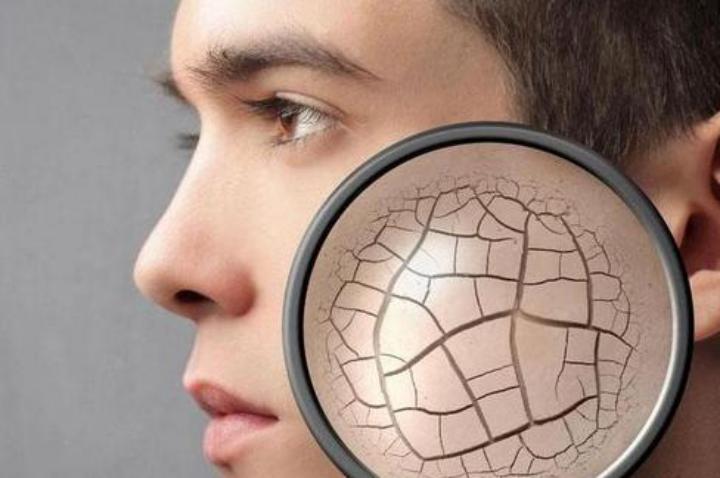 皮肤长斑长痘毛孔粗大的原因,皮肤毛孔粗大什么原因造成的