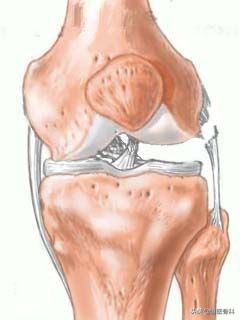膝关节半月板损伤的相关知识,膝关节软骨损伤科普