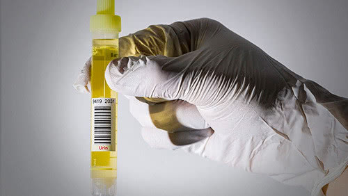 人体八大系统主要功能和病变,人体泌尿系统的组成全解