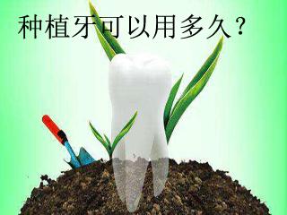 种植牙和烤瓷牙的利弊有哪些,种植牙和烤瓷牙的区别哪个更坚固