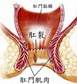宝宝肛裂害怕排便,宝宝排便轻微肛裂怎么办