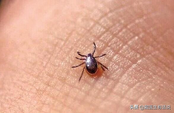 春季常见虫咬,虫咬有什么严重后果