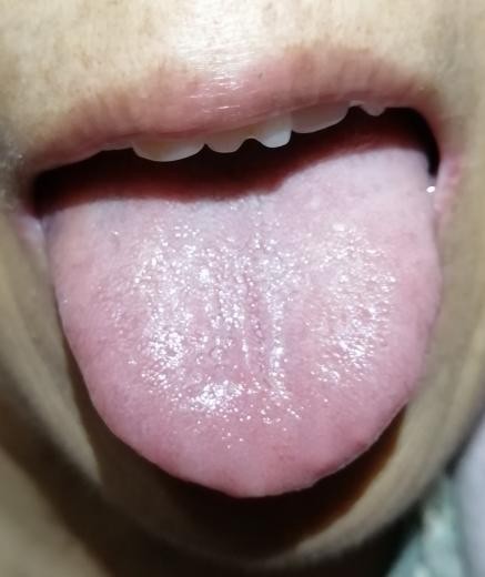 癌症晚期的中草药治疗方法,治疗癌症晚期的民间好医生