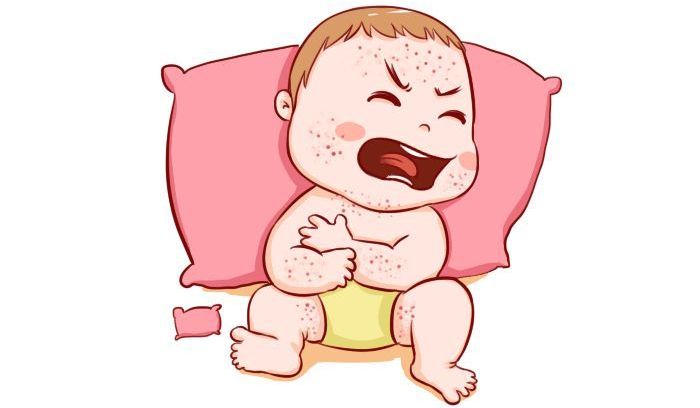 宝宝身上各类疹子识别图,宝宝皮疹的症状和治疗