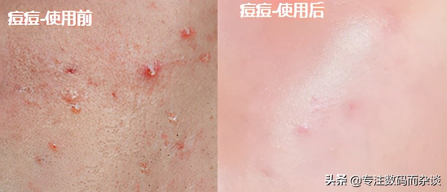 小米显微镜10万倍,小米显微镜有用吗