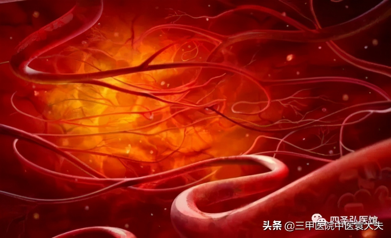 迈入中医之门第89篇：中医视角解读“疼痛论治”