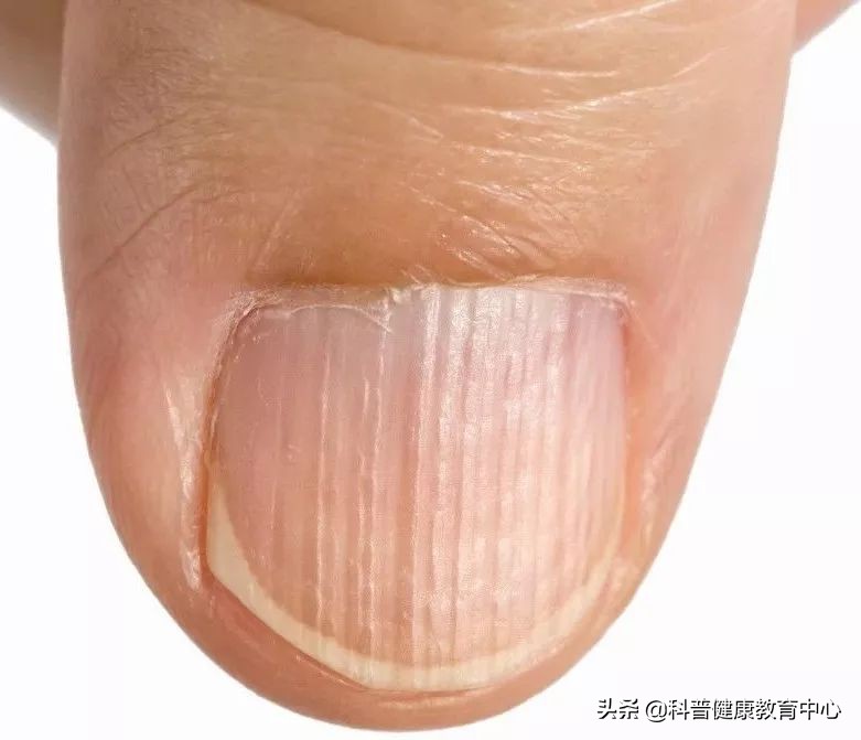 手相的科学解释,从医学角度解读手相的秘密