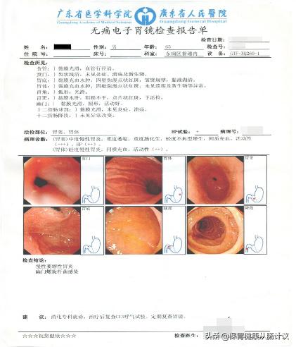 萎缩性胃炎你需要知道的5个点,萎缩性胃炎很吓人看完你就懂了