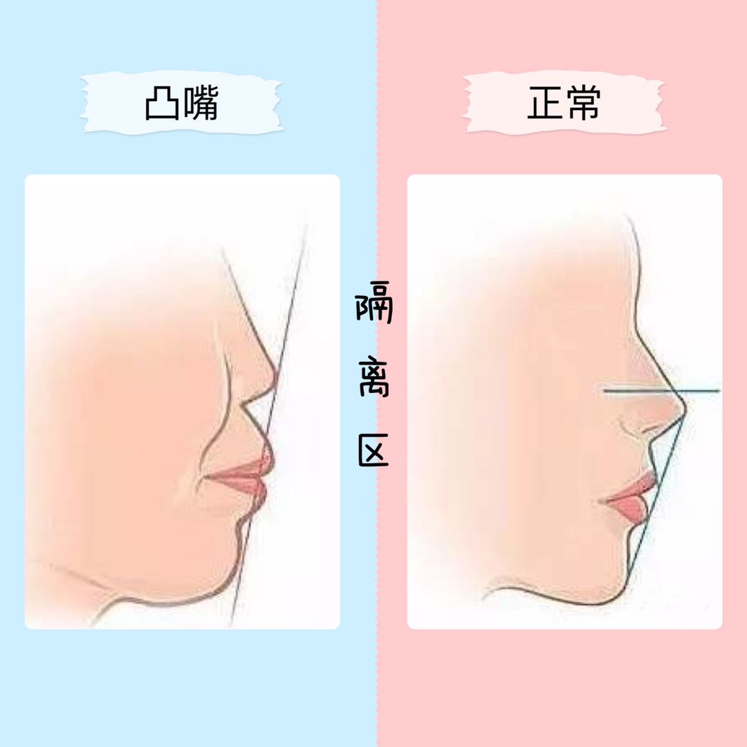 按摩脸部可以消除法令纹?郑爽、范冰冰亲自示范,我劝你别按了