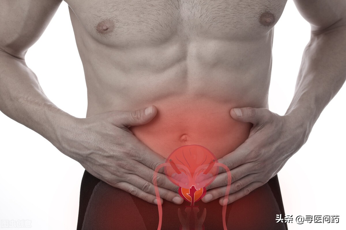 男性一定要注意这几件事,男人预防男性病有六忌