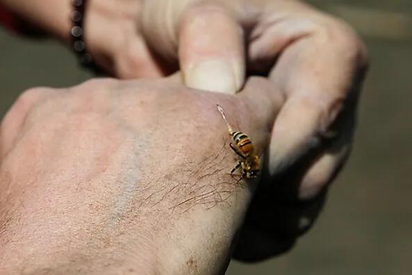 如果不小心被蜜蜂蛰到脚上怎么办,如果不小心被蜜蜂蛰了该怎么办