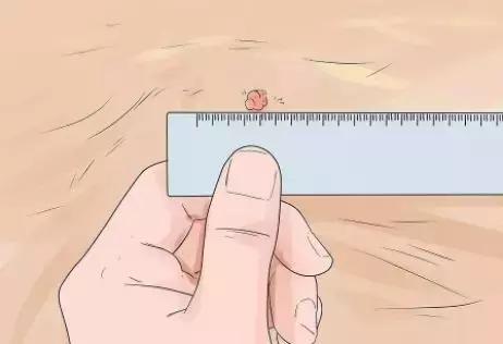 狗狗身上瘊子怎么去除,狗狗身上的斑点怎么去除