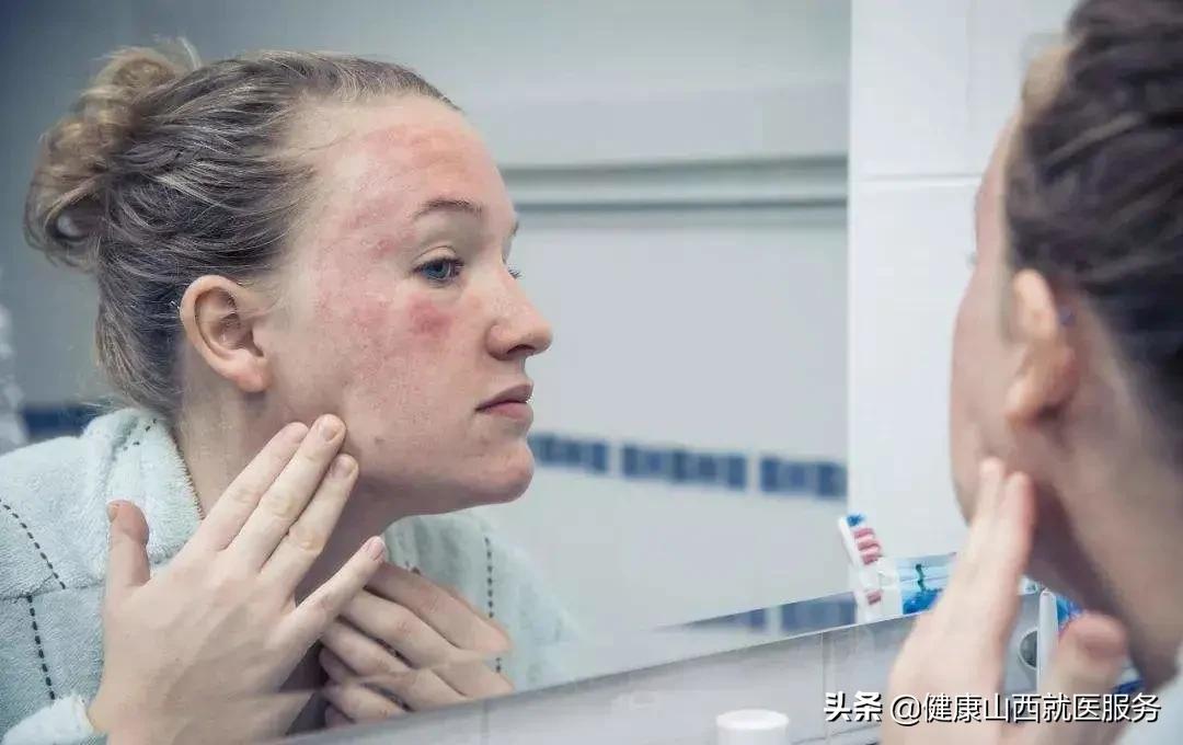 皮肤干燥缺水是补水还是保湿呢,皮肤干燥怎么补水保湿最快