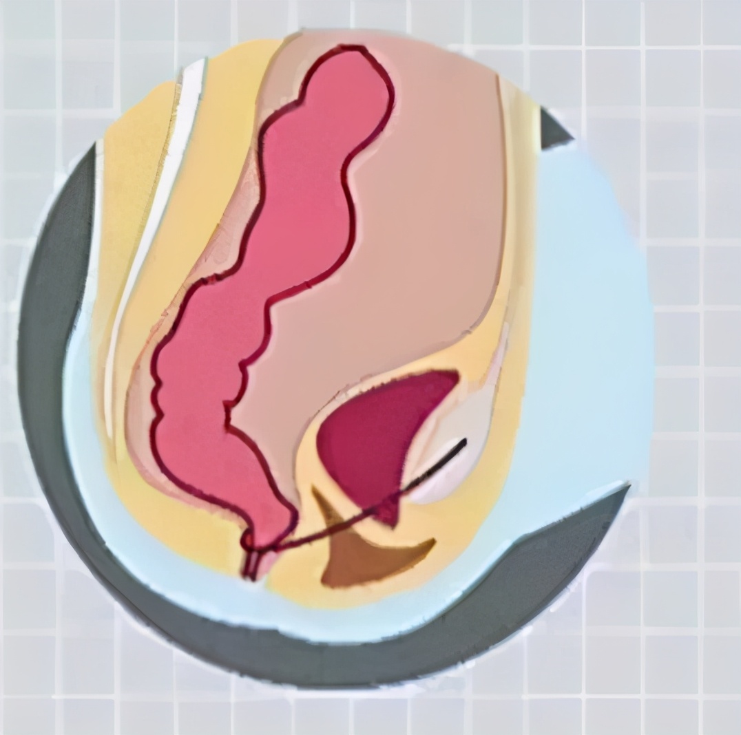 天冷了为什么容易便秘怎样改善,便秘是怎么回事呢
