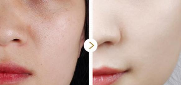 收敛细致毛孔精华液原液评测,细腻毛孔修复精华原液