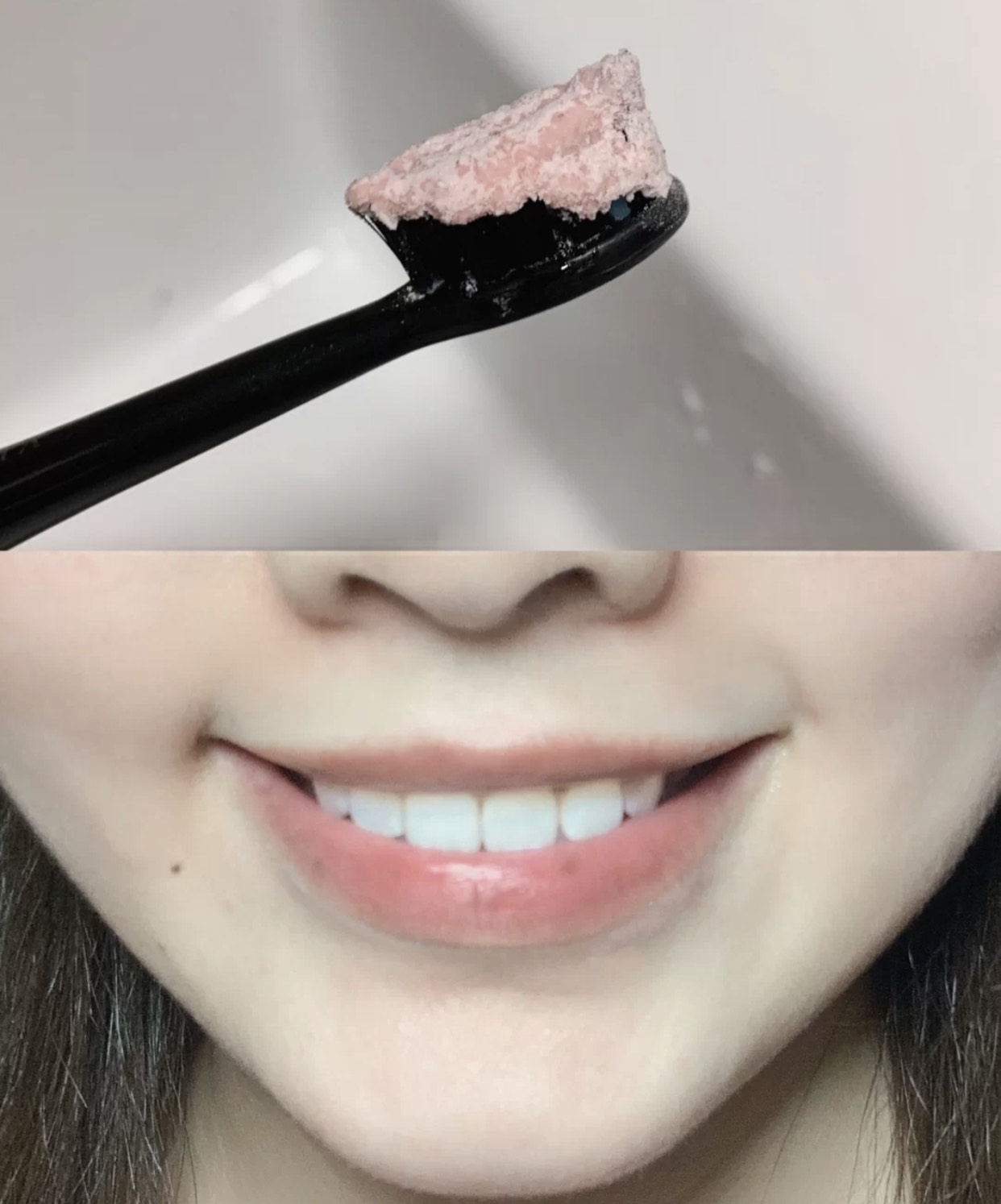 无危害的牙贴,市面上卖的美牙贴管用吗