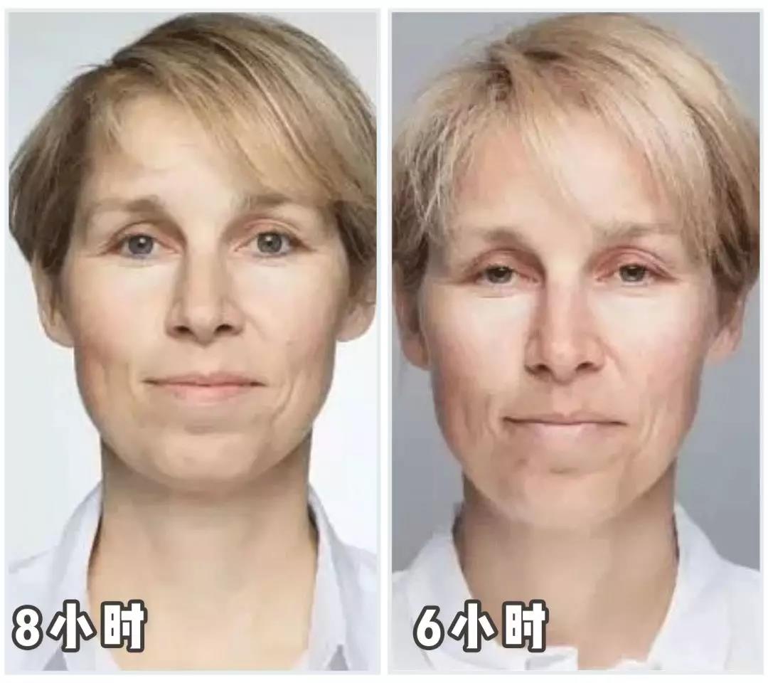 管不住自己的手老是挤痘痘,管不住手喜欢挤痘痘