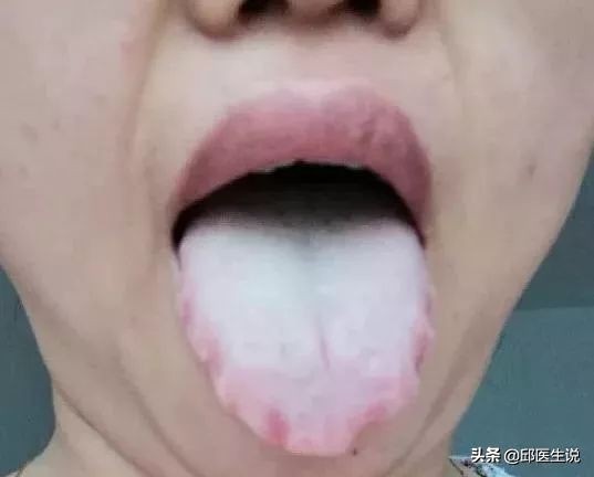 解决身体的湿气的偏方,身体湿气太重自己在家怎样除掉